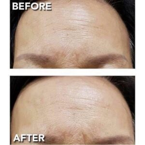 Tinh chất tiêm DNA cá hồi