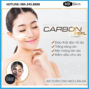 Laser Carbon Peel là gì?