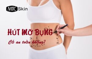 Hút mỡ bụng có nguy hiểm không