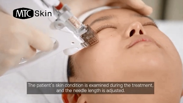 Máy tiêm tinh chất BellaPro