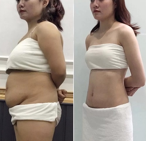 Kết quả sau điều trị