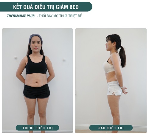 Kết quả sau điều trị