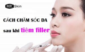 Cách chăm sóc sau khi tiêm filler
