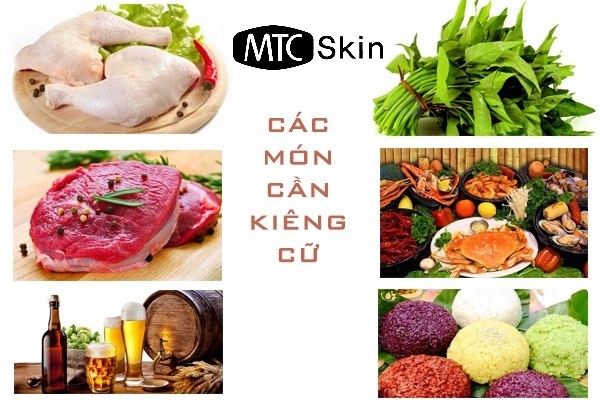 các món cần kiêng cữ sau tiêm filler