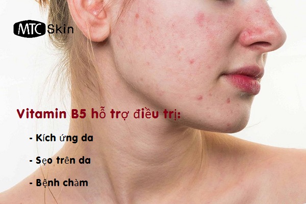 Vitamin B5 giúp khắc phục một số bệnh lý ngoài da