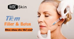 tiêm filler và botox khác nhau như thế nào