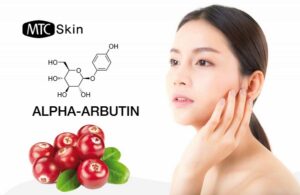 Arbutin kết hợp với gì để tăng hiệu quả làm trắng, trị nám?