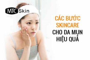 Các bước skincare cho da mụn chuẩn nhất từ chuyên gia
