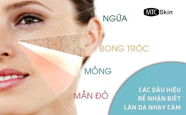 làn da nhạy cảm