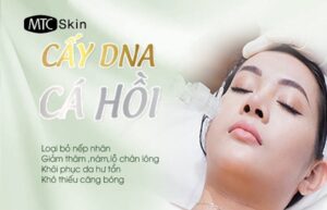 Cấy DNA cá hồi là gì? Cấy DNA cá hồi có tốt không?