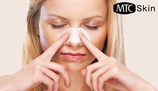 Không cạo lông, lột mụn sau điện di C