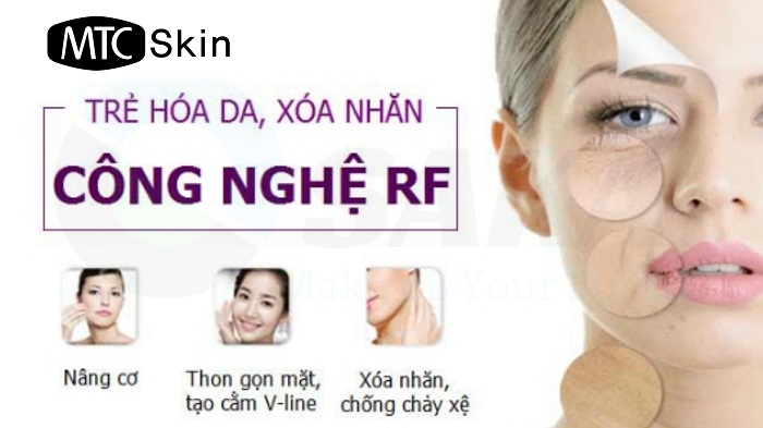 Công nghệ nâng cơ mặt bằng sóng RF
