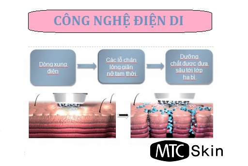 Điện di là gì?