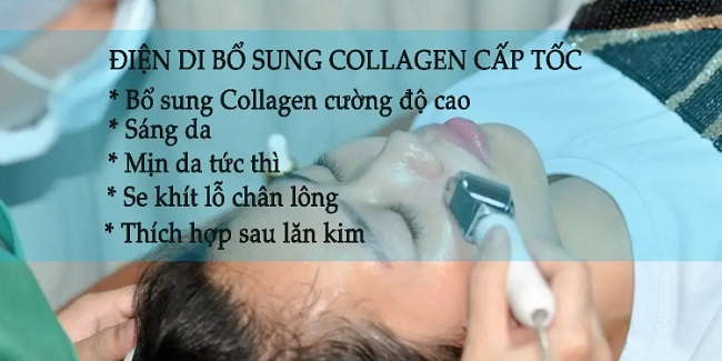 Điện di collagen