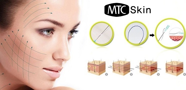 Nâng cơ mặt có hại không?