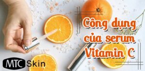 Tác dụng của serum vitamin C và những lưu ý khi sử dụng