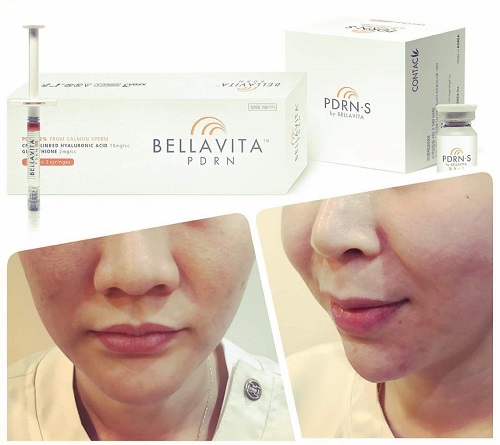 PDRN cá hồi của  BellaVita có tốt không?