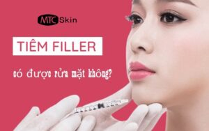 Tiêm filler có được rửa mặt không
