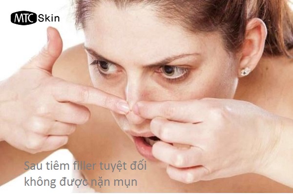 Tiêm filler có nặn mụn được không?