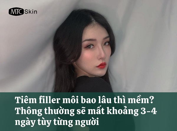 Sau khi tiêm filler bao lâu thì mềm?