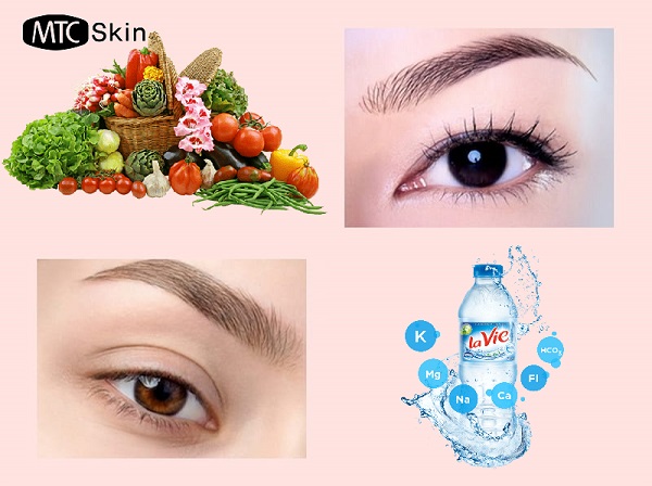 chế độ ăn uống