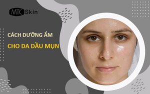 Cách dưỡng ẩm cho da dầu mụn tại nhà an toàn, hiệu quả nhất