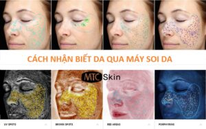 Cách nhận biết da qua máy soi da