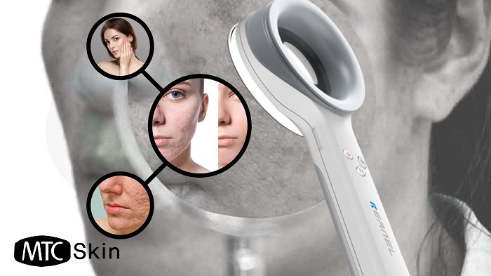 máy soi giúp phát hiện bệnh về da