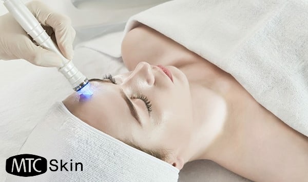 Liệu trình Aqua peel