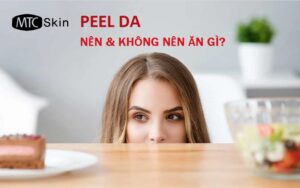 Peel da kiêng ăn gì?