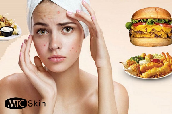 Peel da kiêng ăn gì?