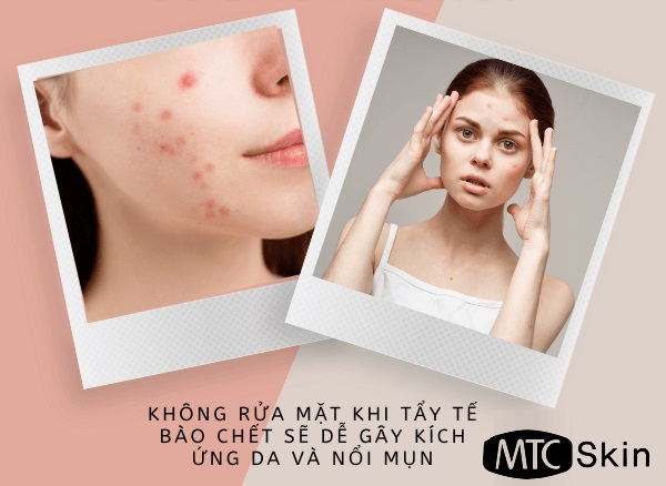 Tẩy da chết xong có nên rửa mặt không?