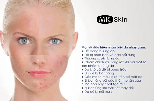 Cách nhận biết da nhạy cảm