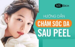 Chăm sóc da sau peel: 10 điều nên và không nên làm