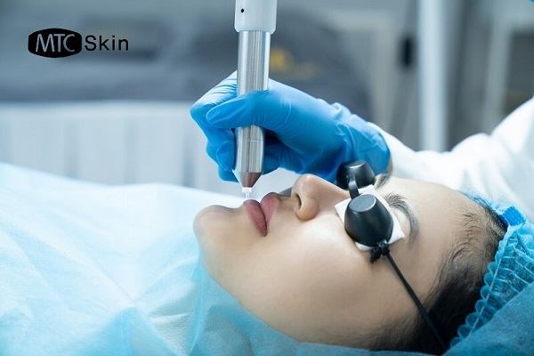 Công nghệ Plasma trong thẩm mỹ có tốt không?