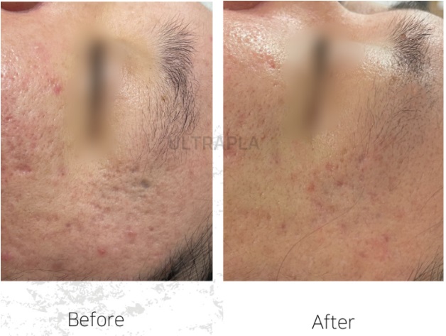 hiệu quả điều trị