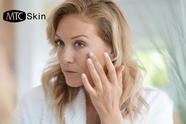 Nguyên nhân gây mất collagen