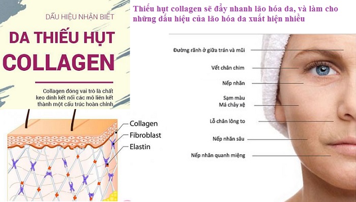 Tác hại của việc thiếu hụt collagen