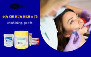 Kem ủ tê mua ở đâu? Kinh nghiệm mua kem ủ tê chính hãng