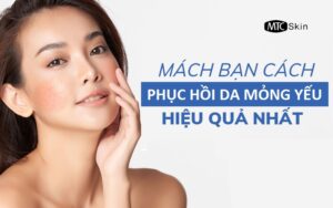 Cách phục hồi da mỏng yếu, giúp da căng bóng, khỏe mạnh