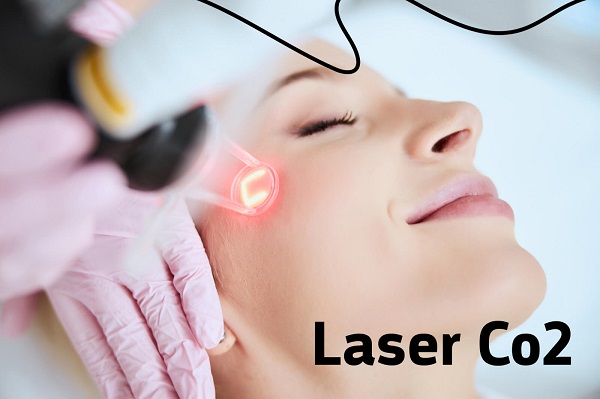 Điều trị tái tạo bề mặt bằng laser