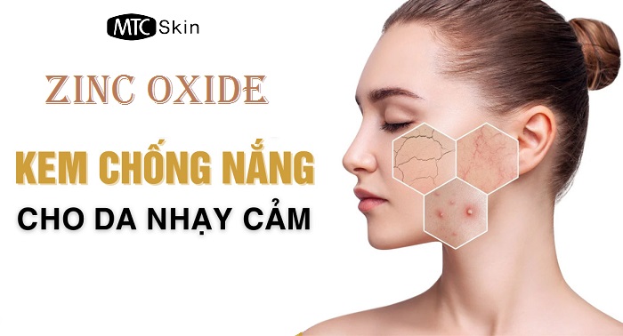 Ưu điểm của kem chống nắng chứa oxit kẽm