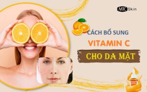 Cách bổ sung vitamin C cho da mặt hiệu quả nhất
