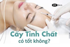Cấy tinh chất vào da có tốt không