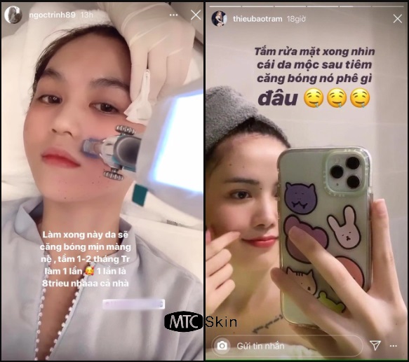 Cấy tinh chất vào da có tốt không?