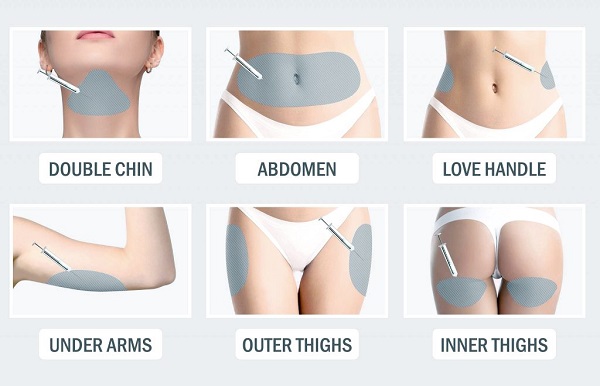 các vùng điều trị