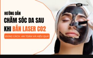 Hướng dẫn cách chăm sóc da sau khi bắn laser carbon