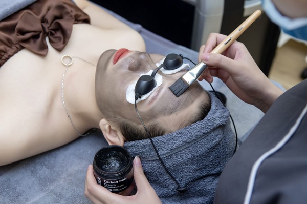 Laser Carbon Peel Cream