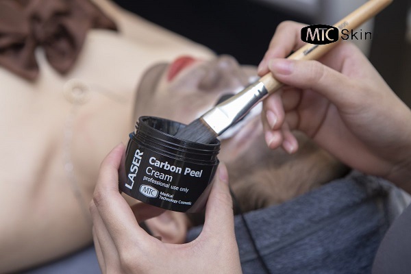 laser carbon peel cream